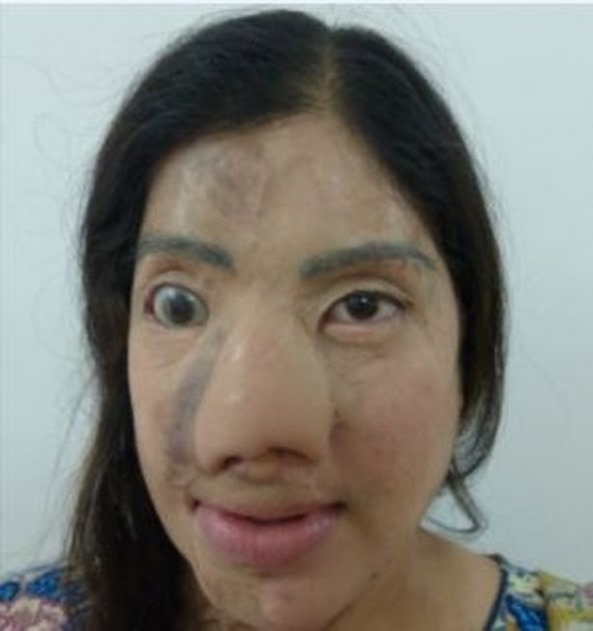 cosmetic face surgery