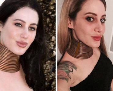 Woman Stretches Neck To Extremes So She Can Look Like Her Favorite Animal