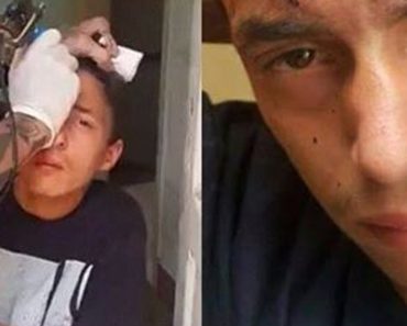Men Arrested For Tattooing Message On Teen’s Forehead Because They Believe He Stole Disabled Man’s Bicycle
