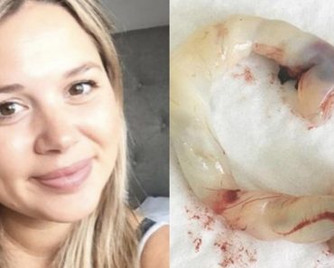 New Mom Posts Picture Of Her Newborn Child’s Knotted Umbilical Cord