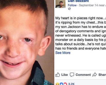 7-Year-Old Is Called Ugly And A “Monster” By Bullies, Then His Dad Posts Big Lesson