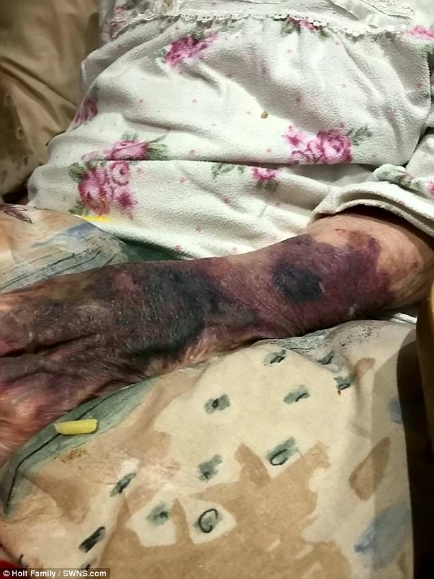 care home abuses 